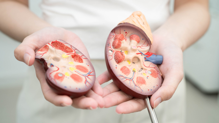 Cystinose: Leber anatomisches Modell