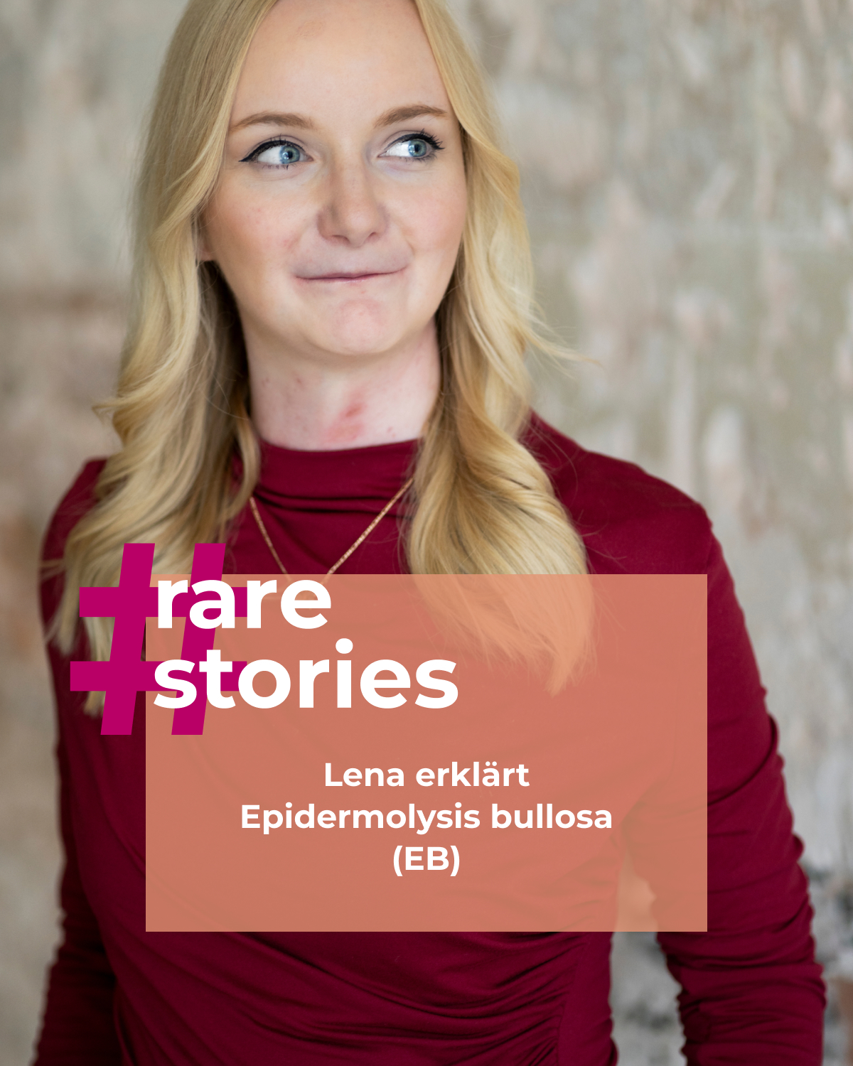 rarestories by Chiesi Instagram